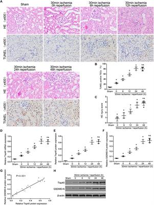 Tisp40 Induces Tubular Epithelial Cell GSDMD-Mediated Pyroptosis in Renal Ischemia-Reperfusion Injury via NF-κB Signaling